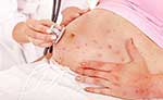 عفونت ویروسی در دوران بارداری