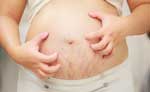 تغییرات پوستی در بارداری | دکتر شبنم وثوقی