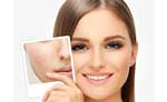 درمان اسکارهای صورت | دکتر اسدالله کیانی