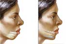 پروتزهای صورت و جراحی چانه | دکتر عباس پریسای