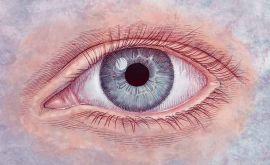 عفونت زیکا در مایع چشم نیز یافت شده است