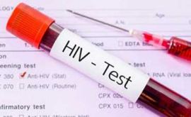 تست اچ ای وی | دکتر حمید قربانی