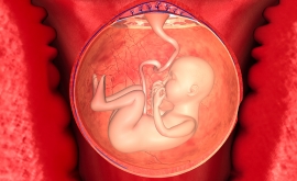 خونریزی در دوران بارداری | دکتر سیده فریبا بهنام