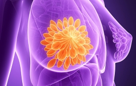 خیلی از خانم های مبتلا به سرطان سینه اطلاعاتی درباره ی سرطان خود ندارند