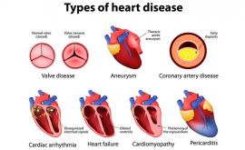 یائسگی زودرس با افزایش احتمال بیماری های قلبی ارتباط دارد