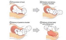 مراحل وضع حمل طبیعی