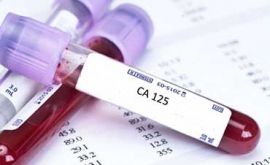 آزمایش ca125 | دکتر لیلا پیرزاده