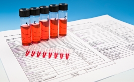 آزمایش خون سالانه می تواند در پیشگیری از مرگ ناشی از سرطان تخمدان مفید باشد