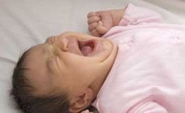 کولیک در نوزادان | دکتر احمد قاسمیان