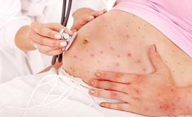 عفونت ویروسی در دوران بارداری | دکتر نجمه سمیعی