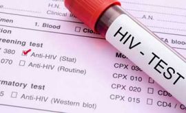 آشنایی با آزمایش ایدز | دکتر پرویندخت حیدری