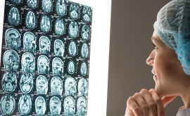 مغز خانم ها در نتیجه آسیب های مغزی دوره نقاهت سخت تری را طی می کند