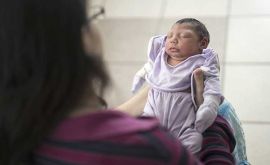 یک مورد از هر بیست خانم باردار مبتلا به زیکا فرزندان ناقصی دارند