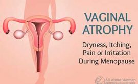 درمان آتروفی واژن | دکتر ویدا تقی پور بازرگانی
