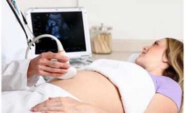 انواع تست های دوران بارداری | دکتر نویدا نوروززاده