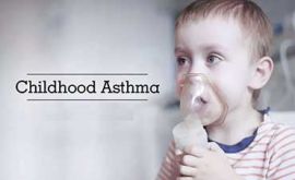 آسم در کودکان زیر 5 سال