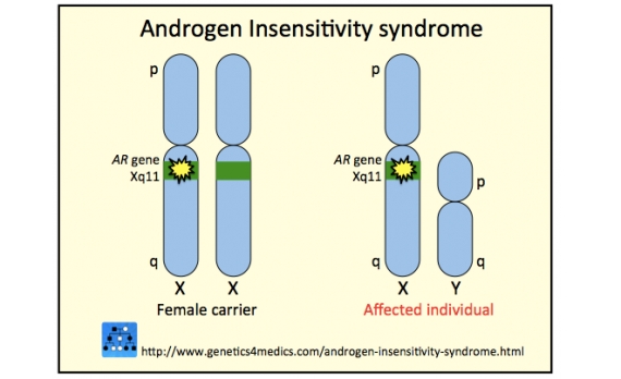 سندرم عدم حساسیت به آندروژن - مرور سریع