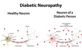 نوروپاتی دیابتی | دکتر سعید حفیظی