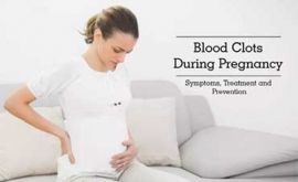 لخته خون در بارداری | دکتر مهتاب مرجانی