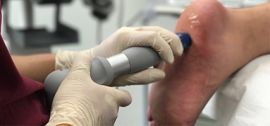 سازمان غذا و دارو دستگاهی را برای درمان زخم های پا ناشی از دیابت تایید کرد